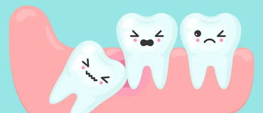 What to Do After Wisdom Tooth Extraction: Recovery Tips for a Smooth Healing Process