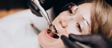 How Often Should You Get Scaling and Polishing for Optimal Oral Health