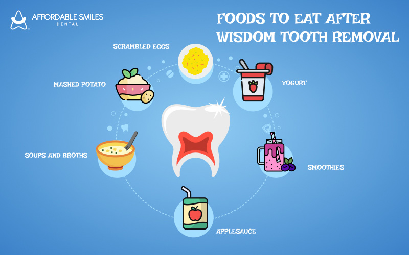 Soft foods to eat after wisdom tooth removal surgery.